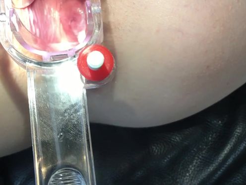 petite nymphet onlyfans a nice, close-up view of my cervix